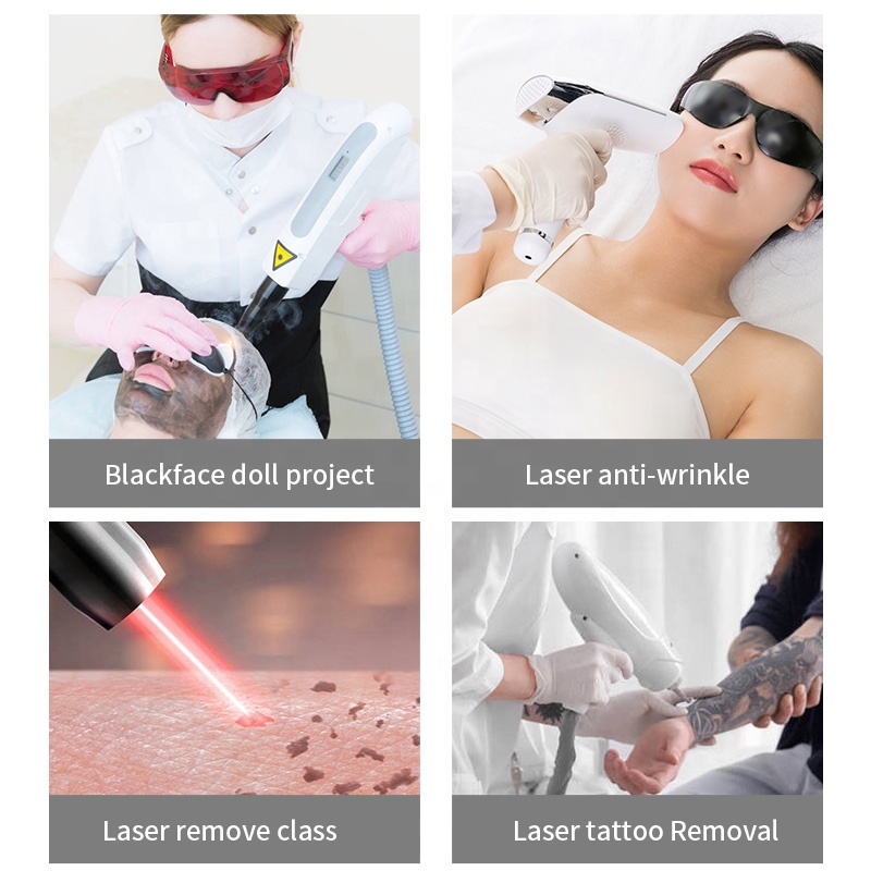 Fabrikpreis 230W Laser-Schönhe – Industrial Laser Price Bewertung und Preis
